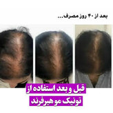 خرید تونیک تقویت کننده مو ۳۰۰ میل BIZ - فروشگاه زیبایی با بیتا