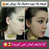 خرید تونیک تقویت کننده مو ۳۰۰ میل BIZ - فروشگاه زیبایی با بیتا
