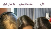 خرید تونیک تقویت کننده مو ۳۰۰ میل BIZ - فروشگاه زیبایی با بیتا
