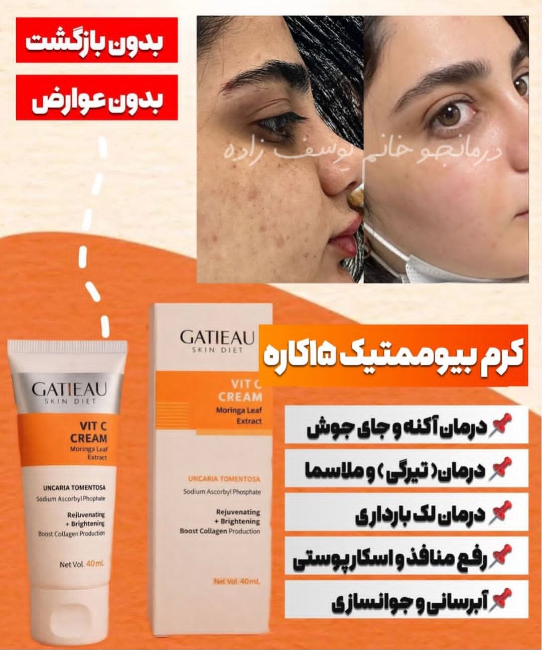 کرم بیوممتیک ضد لک جهانی و روشن کننده کهنده منافذ گاتیو ایتالیا